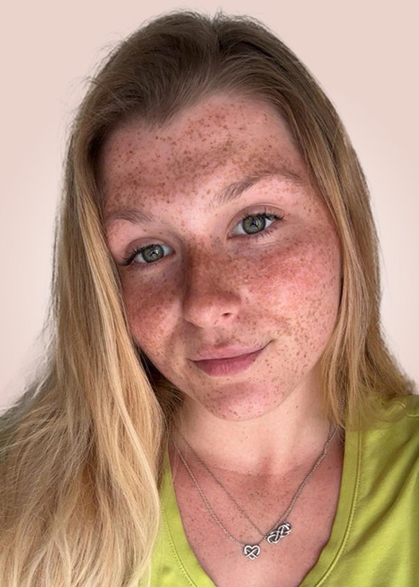 Selina Hönen, Pflegefachkraft bei Lenas Pflegedienst GmbH